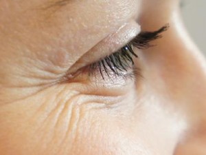 إزالة تجاعيد الوجه وتجاعيد العين